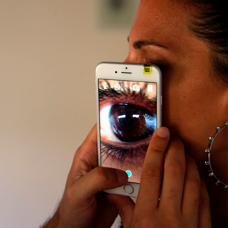 Мини-линза для смартфона Blips Macro - 4